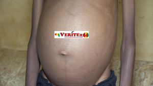 Niankoye Fassou Kolié, souffrant d'une maladie cardiaque