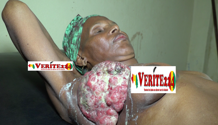 Fatoumata Binta souffre d'une tumeur au sein